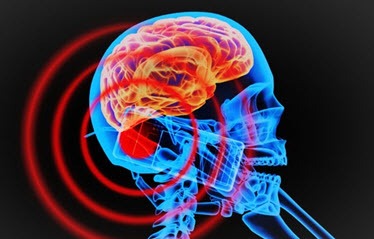 Bức xạ điện từ gây ung thư não