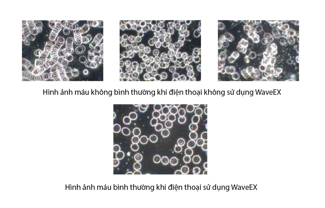 Nghiên cứu Waveex trên mẫu máu tác dụng chống đông vón khi bị tác hại của bức xạ điện từ
